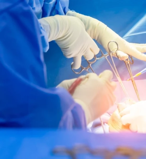 صورة عملية استئصال الناسور الشرجي المنخفض (Fistulectomy)