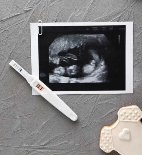 صورة خدمة تحليل الحمل المنزلي الاحترافية